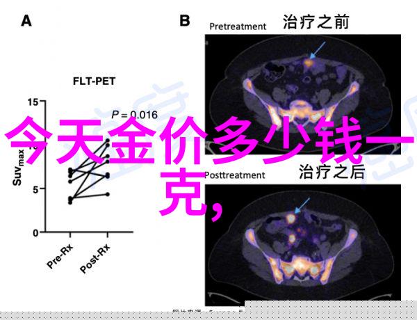 第88届奥斯卡红毯明星的珠宝选择